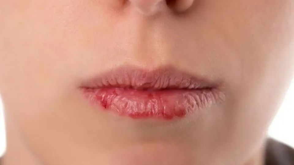 Consejo útiles para evitar las arrugas en los labios.