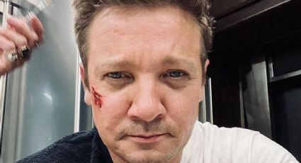 Impactante: Jeremy Renner compartió la primera foto tras el accidente