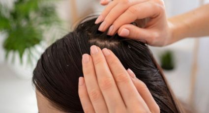 ¿Cómo eliminar la caspa del pelo? 3 remedios caseros que te ayudarán a fortalecer tu cabello