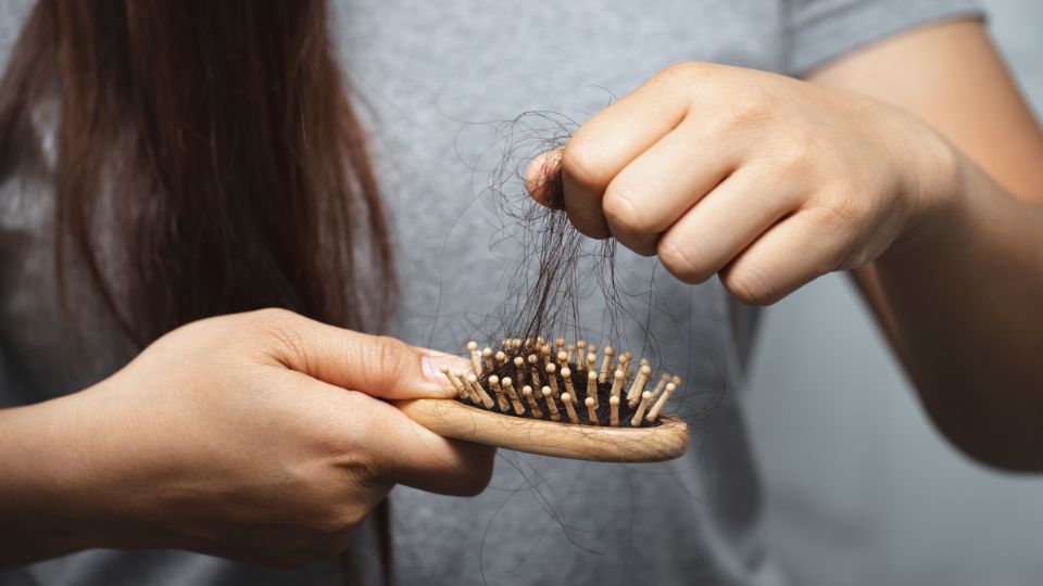 Caída del cabello. Fuente: Pexels.