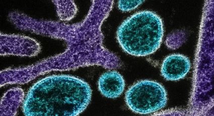 Virus Nipah: ¿Qué es, cuáles son los síntomas y cuántos casos hay en México?