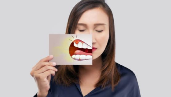 ¿Cómo quitar lo amarillo de los dientes?